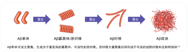 一年内两款新药：阿尔茨海默病的曙光｜海斌访谈