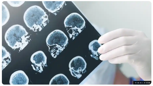 一年内两款新药：阿尔茨海默病的曙光｜海斌访谈